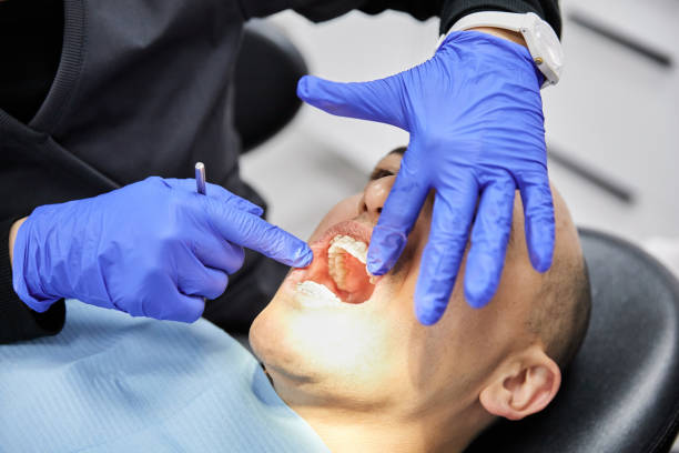 Best After-Hours Emergency Dentist in Cinco Ranch, TX