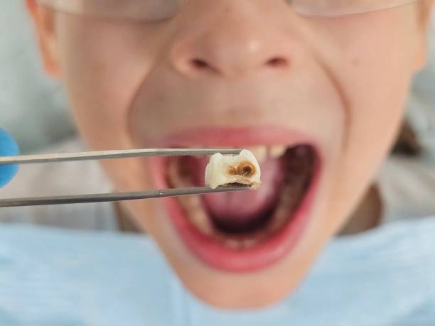 Best Weekend Emergency Dentist in Cinco Ranch, TX